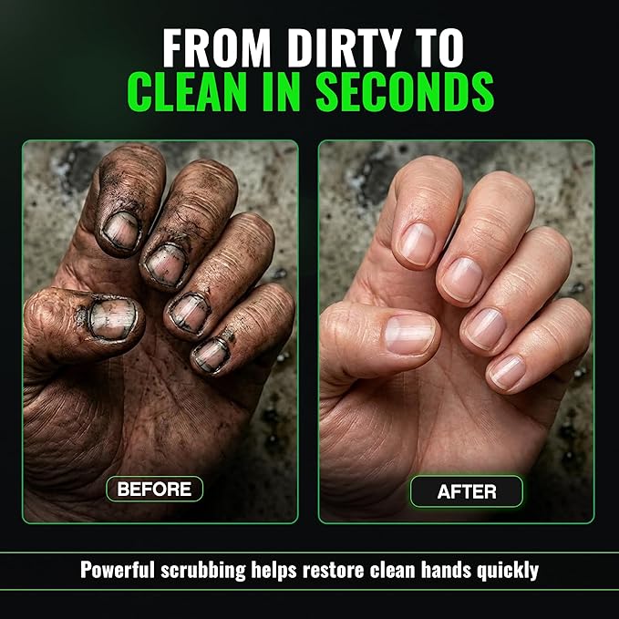 Grip Clean Nail Brush for Cleaning Fingernails – Heavy Duty Nail Brush with Extra Stiff Bristles - Fingernail Brush & Nail Scrubber Brush with Suction Cup Backing for Men & Women - 1 Pack